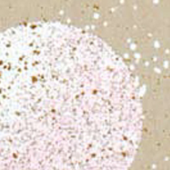EMBOSS ENAMEL SHABBY PINK