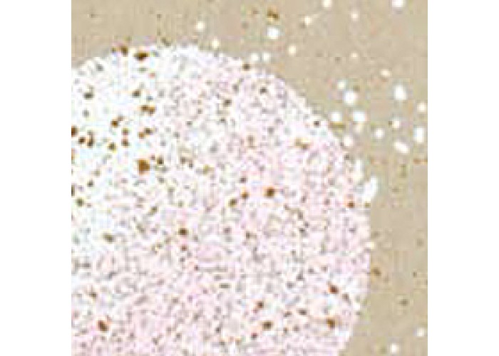 EMBOSS ENAMEL SHABBY PINK EMBOSS ENAMEL SHABBY PINK